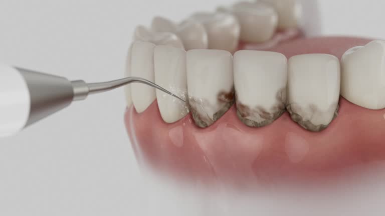Trusted Wisdom Tooth Removal service in McGraw, NY - Dentist Open Now